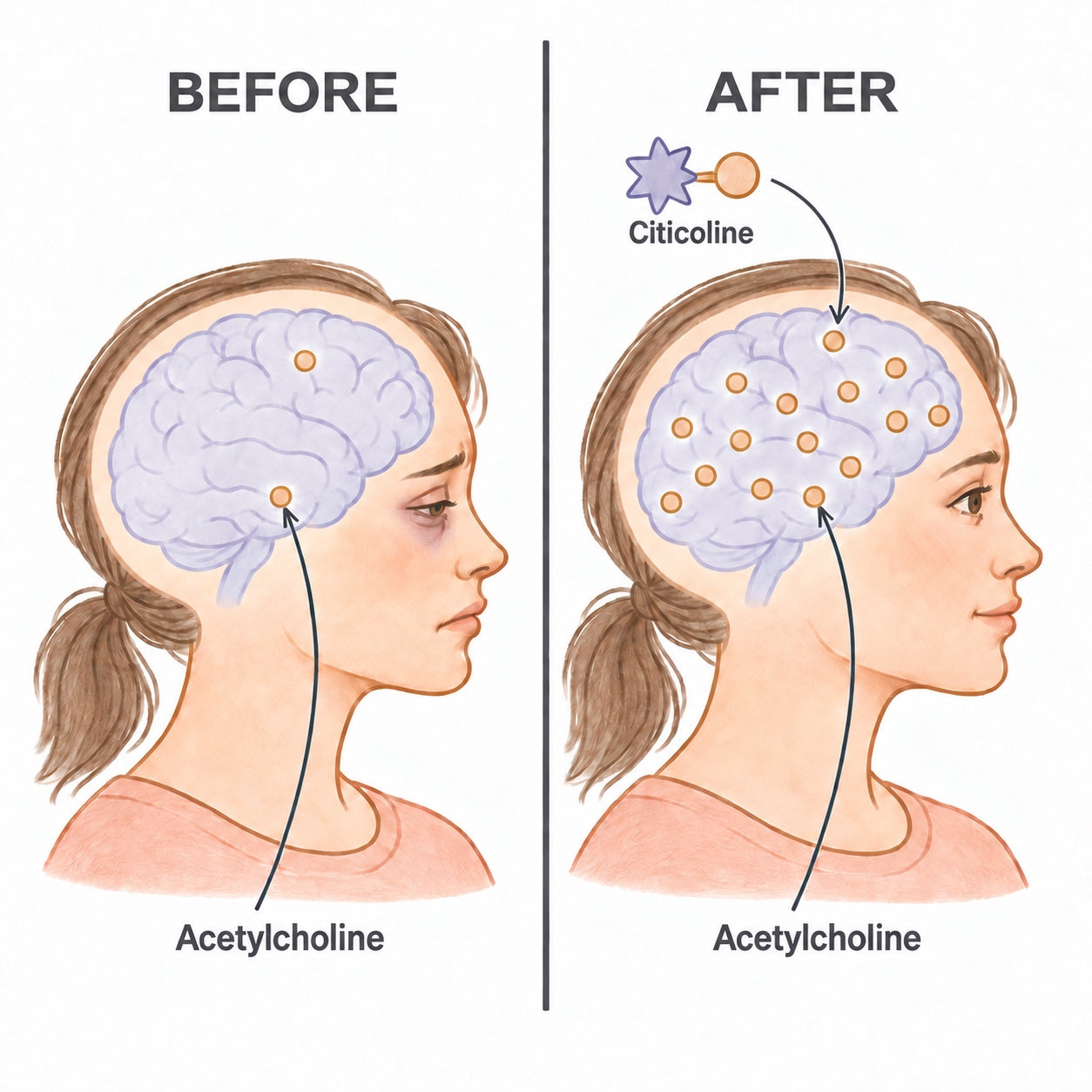 Illustration, before and after: citicoline helping the brain make more acetylcholine